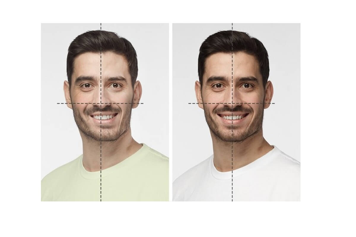 نحوه تشخیص انحراف فک