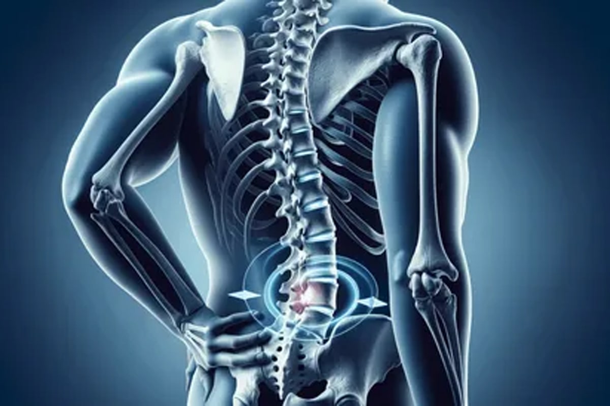 بیرون زدگی دیسک کمر