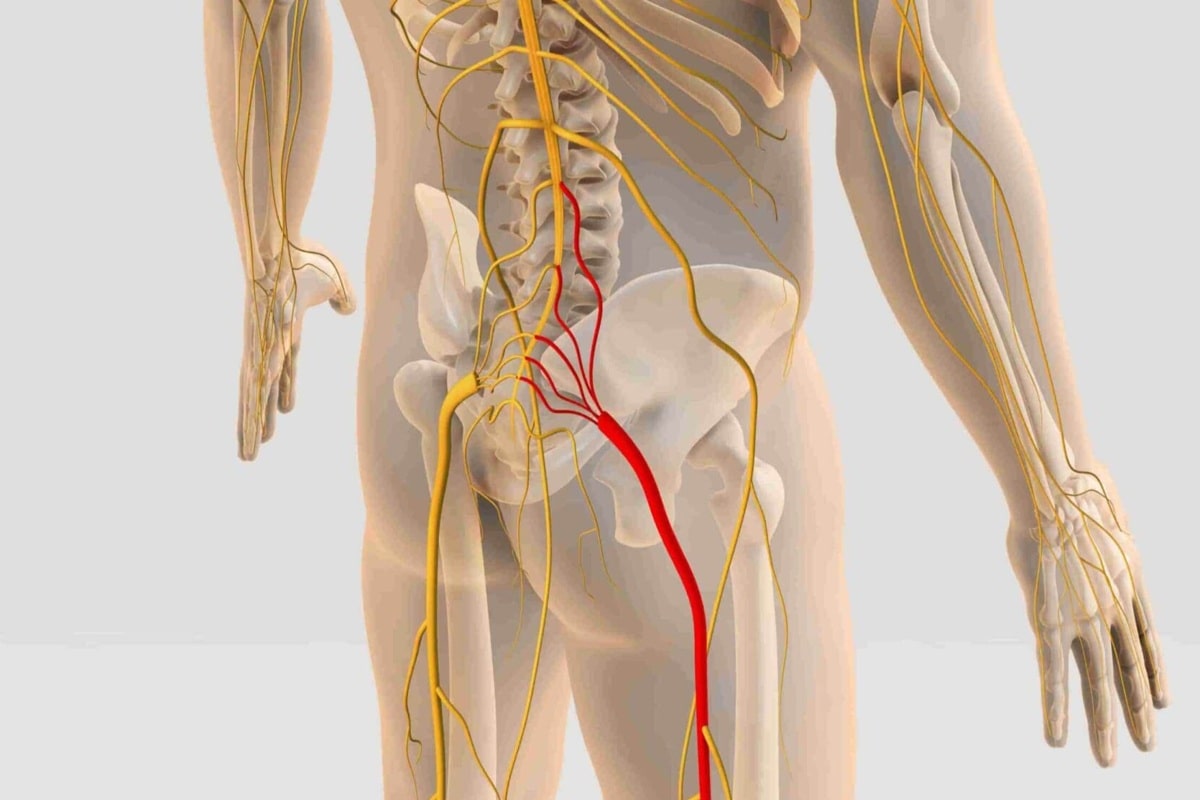 تنگی کانال نخاعی