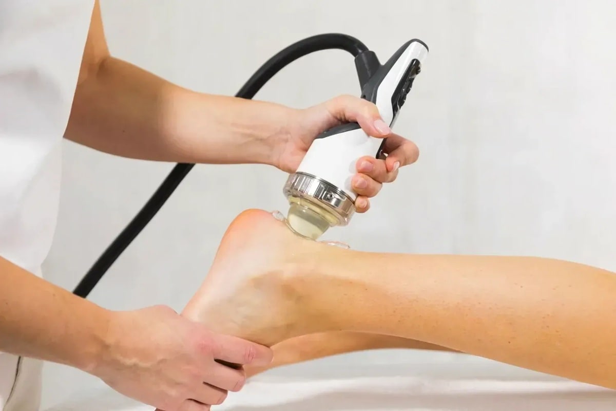 میزان درد شاک ویو تراپی خار پاشنه