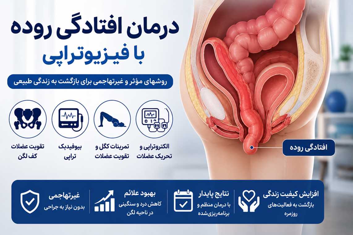 درمان افتادگی روده با فیزیوتراپی